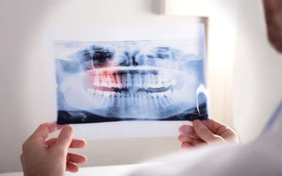 Et si ça venait des dents ?